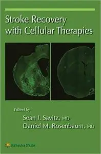 Stroke Recovery with Cellular Therapies (Repost)