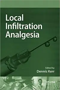 Local Infiltration Analgesia: A Technique to Improve Outcomes after Hip, Knee or Lumbar Spine Surgery