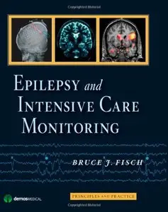 Epilepsy and Intensive Care Monitoring: Principles and Practice