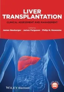Liver Transplantation: Clinical Assessment and Management (repost)