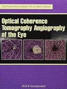 Optical Coherence Tomography Angiography of the Eye: OCT Angiography