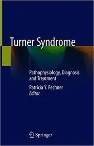 Turner Syndrome: Pathophysiology, Diagnosis and Treatment