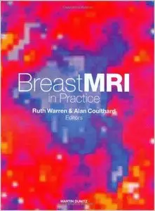 Breast MRI in Practice (repost)