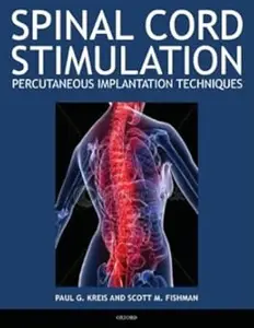 Spinal Cord Stimulation: Percutaneous Implantation Techniques