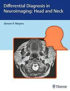 Differential Diagnosis in Neuroimaging: Head and Neck
