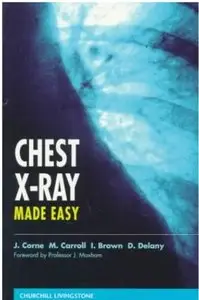Chest X-Ray Made Easy [Repost]
