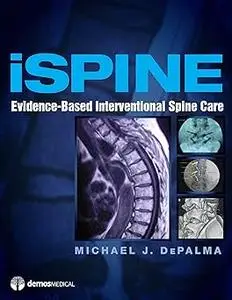 iSpine: Evidence-Based Interventional Spine Care