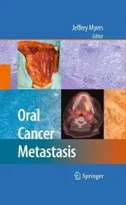 Oral Cancer Metastasis (repost)