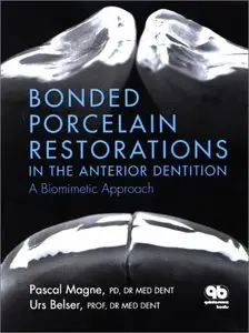 Bonded Porcelain Restorations in the Anterior Dentition: A Biomimetic Approach [Repost]
