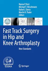 Fast Track Surgery in Hip and Knee Arthroplasty: New Standards