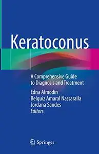 Keratoconus: A Comprehensive Guide to Diagnosis and Treatment