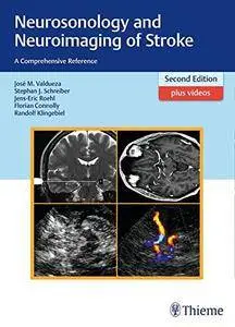 Neurosonology and Neuroimaging of Stroke: A Comprehensive Reference, Second Edition