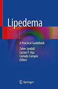 Lipedema: A Practical Guidebook