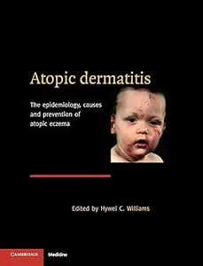 Atopic Dermatitis: The Epidemiology, Causes and Prevention of Atopic Eczema