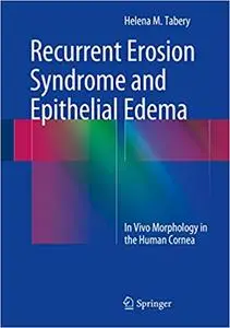 Recurrent Erosion Syndrome and Epithelial Edema: In Vivo Morphology in the Human Cornea