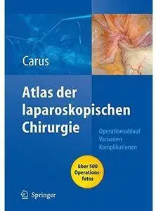 Operationsatlas Laparoskopische Chirurgie: Indikationen - Operationsablauf - Varianten - Komplikationen [Repost]