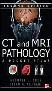 CT & MRI Pathology: A Pocket Atlas, Second Edition (repost)
