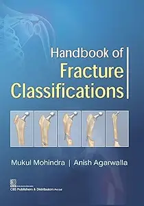 Handbook of Fracture Classifications