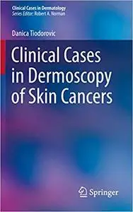 Clinical Cases in Dermoscopy of Skin Cancers (repost)