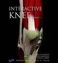 Interactive Knee 1.1 (Primal)