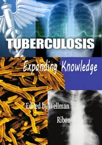 "Tuberculosis: Expanding Knowledge" ed. by Wellman Ribon