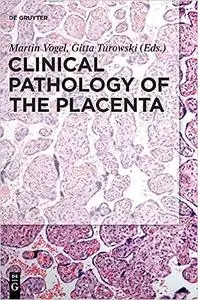 Clinical Pathology of the Placenta