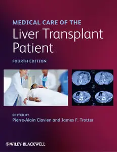 Medical Care of the Liver Transplant Patient (Repost)