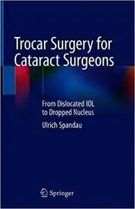 Trocar Surgery for Cataract Surgeons: From Dislocated IOL to Dropped Nucleus