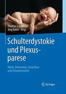 Schulterdystokie und Plexusparese: Klinik, Prävention, Gutachten und Dokumentation (Repost)