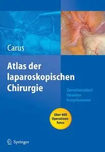 Atlas der laparoskopischen Chirurgie: Operationsablauf - Varianten - Komplikationen