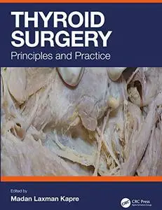 Thyroid Surgery: Principles and Practice