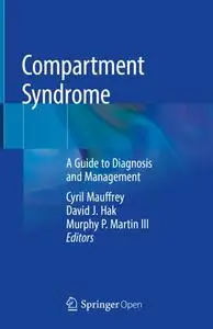 Compartment Syndrome A Guide to Diagnosis and Management