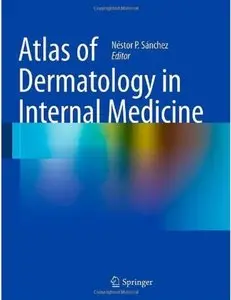 Atlas of Dermatology in Internal Medicine