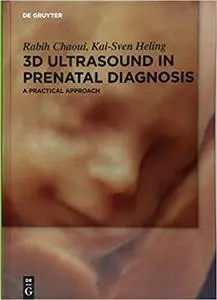 3D Ultrasound in Prenatal Diagnosis