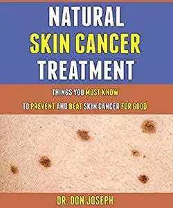 Natural Skin Cancer Treatment: Things You Must Know To Prevent And Beat Skin Cancer For Good.