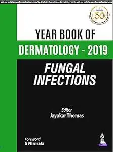 Fungal Infections