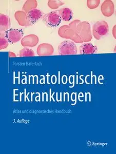 Hämatologische Erkrankungen: Atlas und diagnostisches Handbuch (Repost)