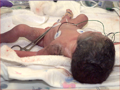 Textbook of Neonatal Resuscitation REAL DVD 2006 Edition with 2007 Update (Repost)
