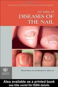 An Atlas of Diseases of the Nail   [Repost]