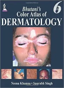 Bhutani's Color Atlas of Dermatology, 6th edition