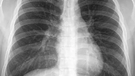 Introduction To X Rays And Their Use In Clinical Practice