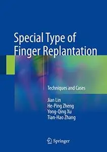 Special Type of Finger Replantation: Techniques and Cases (Repost)