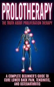 Prolotherapy: The Truth About Proliferation Therapy: A Complete Beginner's Guide to Cure Lower Back Pain, Tendinitis
