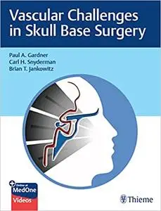 Vascular Challenges in Skull Base Surgery