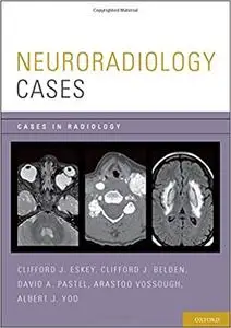 Neuroradiology Cases