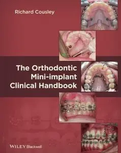 The Orthodontic Mini-implant Clinical Handbook (repost)