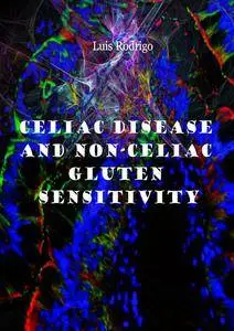 "Celiac Disease and Non-Celiac Gluten Sensitivity" ed. by Luis Rodrigo