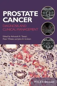 Prostate Cancer: Diagnosis and Clinical Management (Repost)