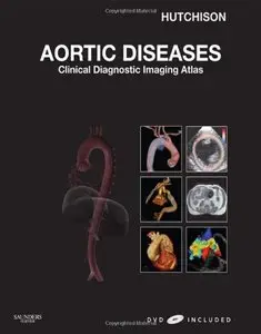 Aortic Diseases: Clinical Diagnostic Imaging Atlas (repost)
