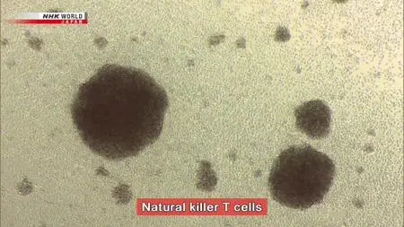 Medical Frontiers - Cancer Immunotherapy: Targeting Tumors with Light and Antibodies (2021)